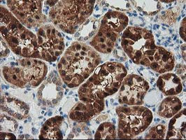 GRHPR Antibody in Immunohistochemistry (Paraffin) (IHC (P))