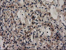 GRHPR Antibody in Immunohistochemistry (Paraffin) (IHC (P))