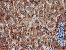 GRHPR Antibody in Immunohistochemistry (Paraffin) (IHC (P))