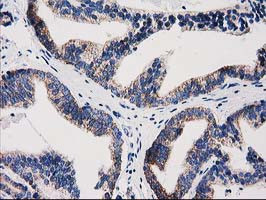 GRHPR Antibody in Immunohistochemistry (Paraffin) (IHC (P))