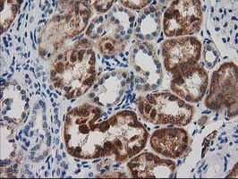 GRHPR Antibody in Immunohistochemistry (Paraffin) (IHC (P))