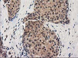 GRHPR Antibody in Immunohistochemistry (Paraffin) (IHC (P))