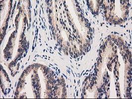 GRHPR Antibody in Immunohistochemistry (Paraffin) (IHC (P))