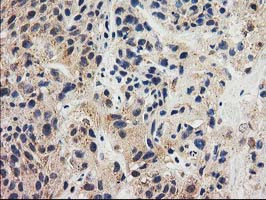 GRHPR Antibody in Immunohistochemistry (Paraffin) (IHC (P))