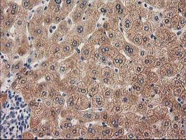 GRHPR Antibody in Immunohistochemistry (Paraffin) (IHC (P))