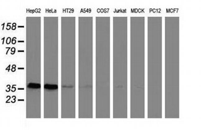 GRHPR Antibody in Western Blot (WB)