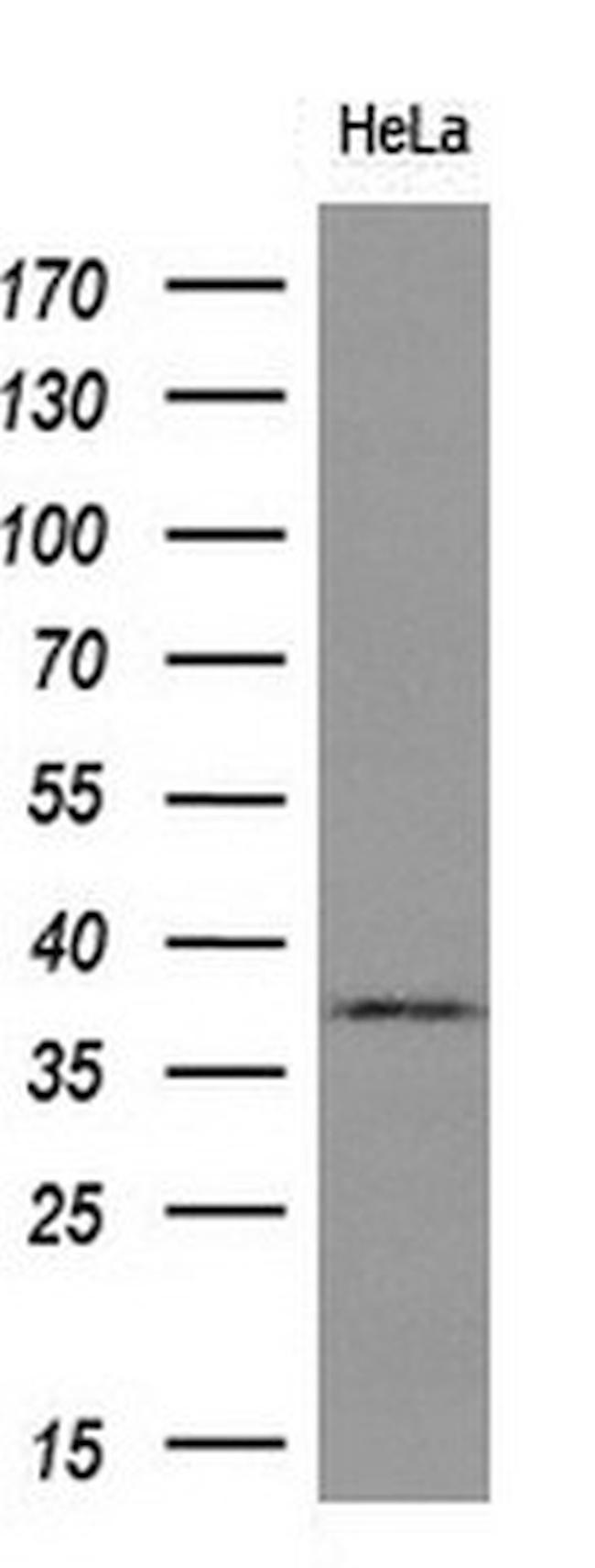 GRHPR Antibody in Western Blot (WB)