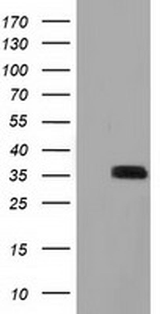 GRHPR Antibody in Western Blot (WB)