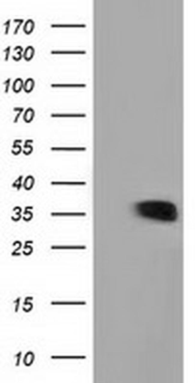 GRHPR Antibody in Western Blot (WB)