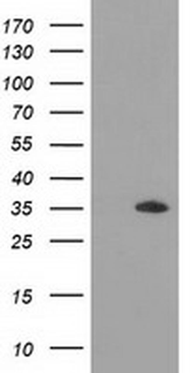 GRHPR Antibody in Western Blot (WB)