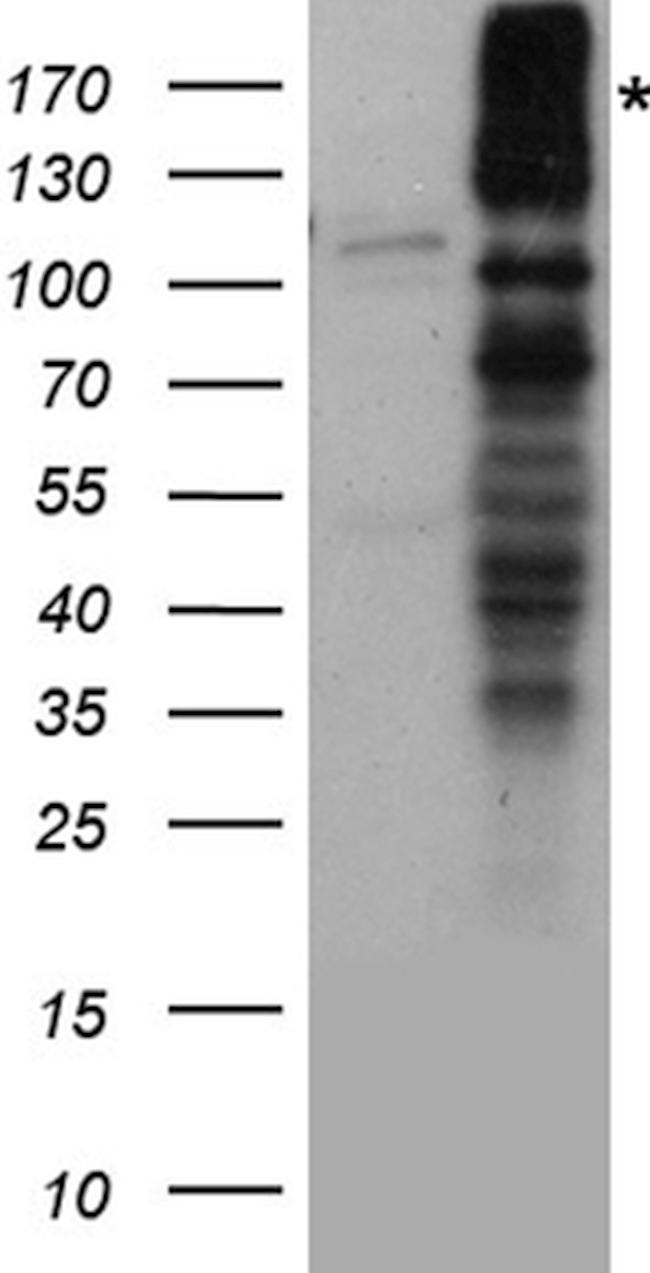 GRIN2A Antibody in Western Blot (WB)