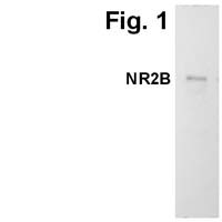 NMDAR2B Antibody in Western Blot (WB)