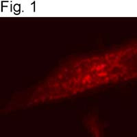 SRC2 Antibody in Immunocytochemistry (ICC/IF)