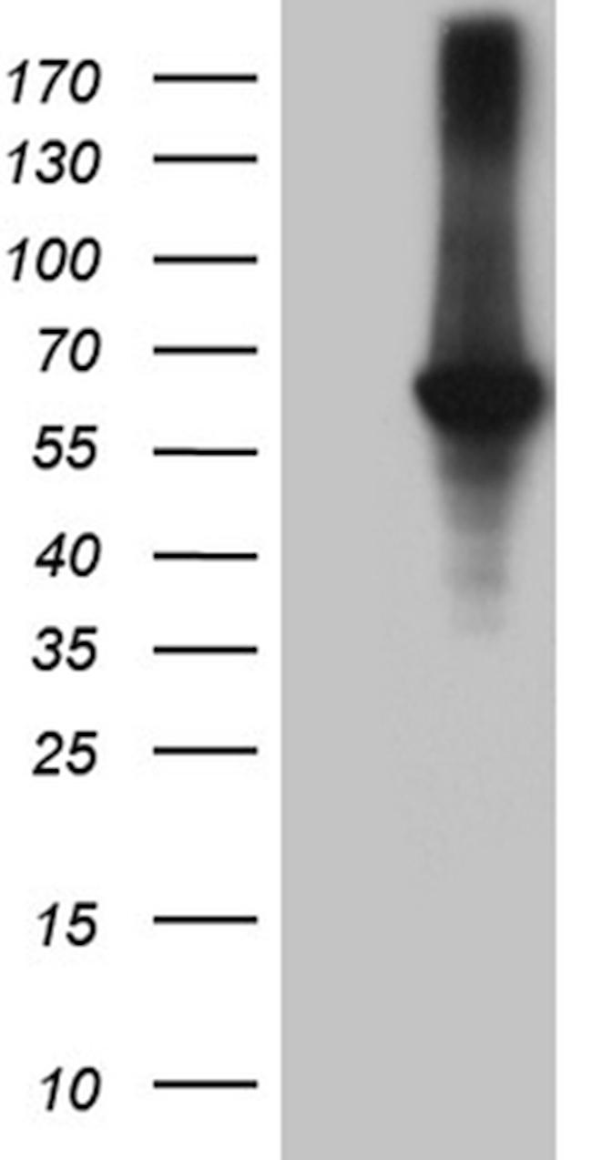 GRK1 Antibody in Western Blot (WB)