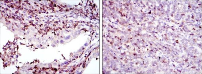 GRK2 Antibody in Immunohistochemistry (Paraffin) (IHC (P))