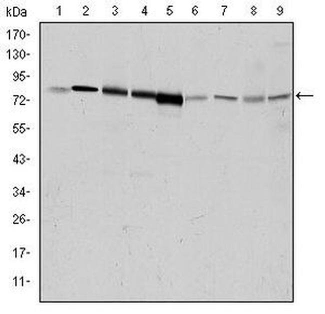 GRK2 Antibody in Western Blot (WB)