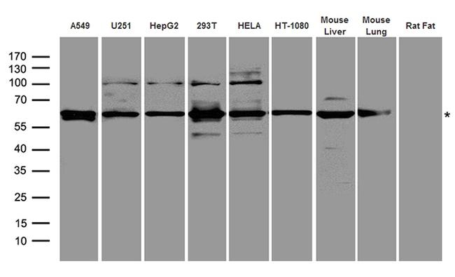 GRK5 Antibody in Western Blot (WB)