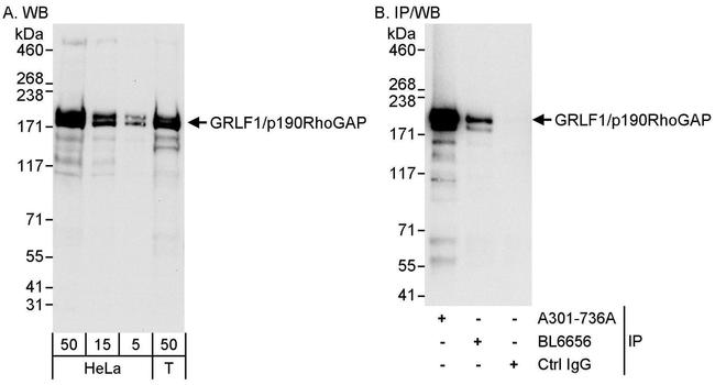 GRLF1/p190RhoGAP Antibody in Western Blot (WB)