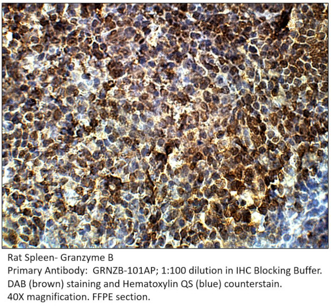 Granzyme B Antibody in Immunohistochemistry (IHC)