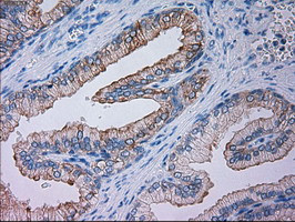 GSC Antibody in Immunohistochemistry (Paraffin) (IHC (P))