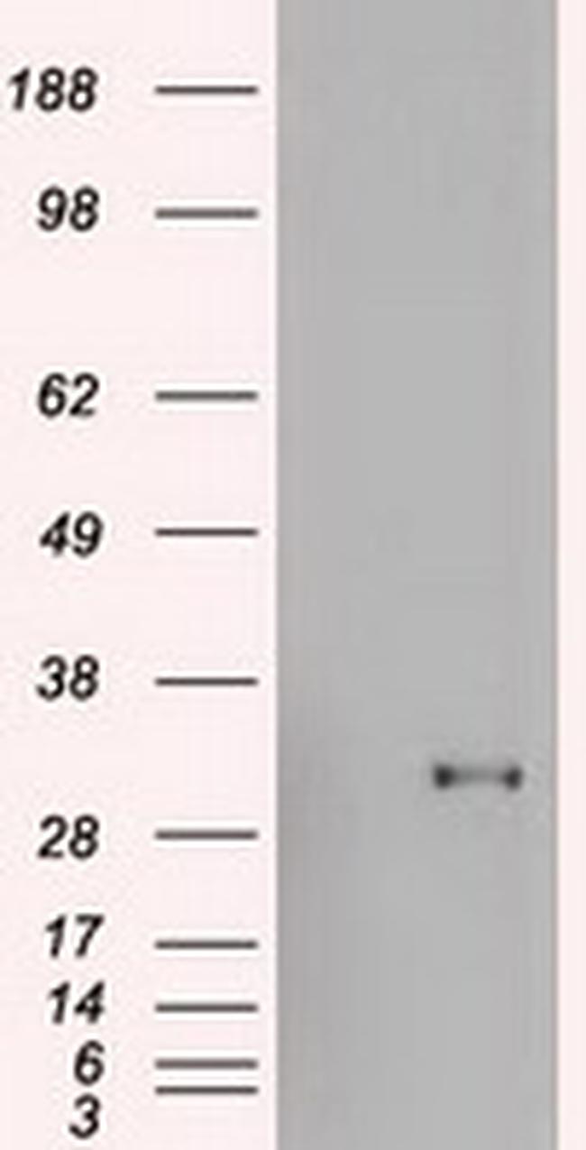 GSC Antibody in Western Blot (WB)