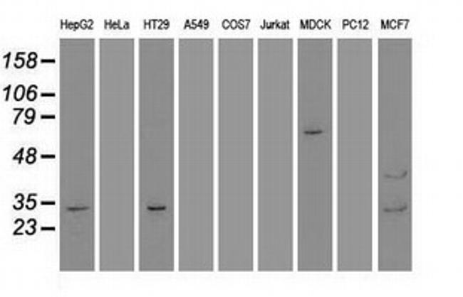 GSC Antibody in Western Blot (WB)