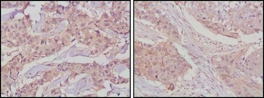 GSK3B Antibody in Immunohistochemistry (Paraffin) (IHC (P))