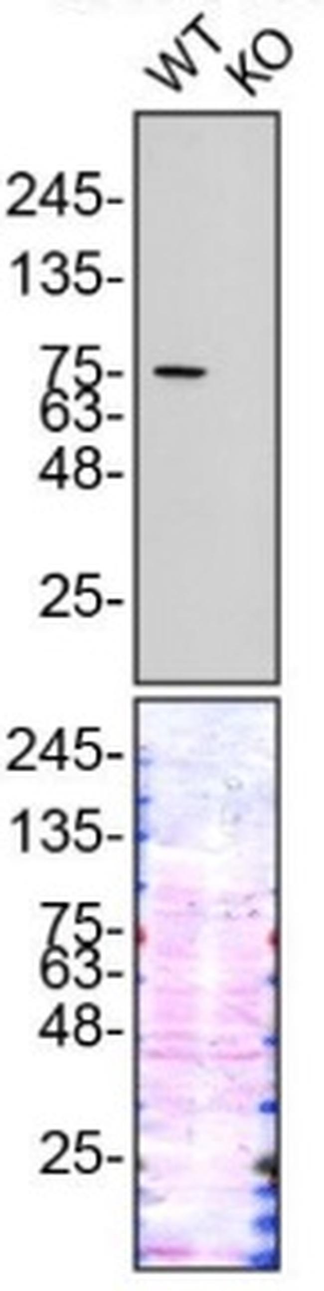 Gelsolin Antibody in Western Blot (WB)