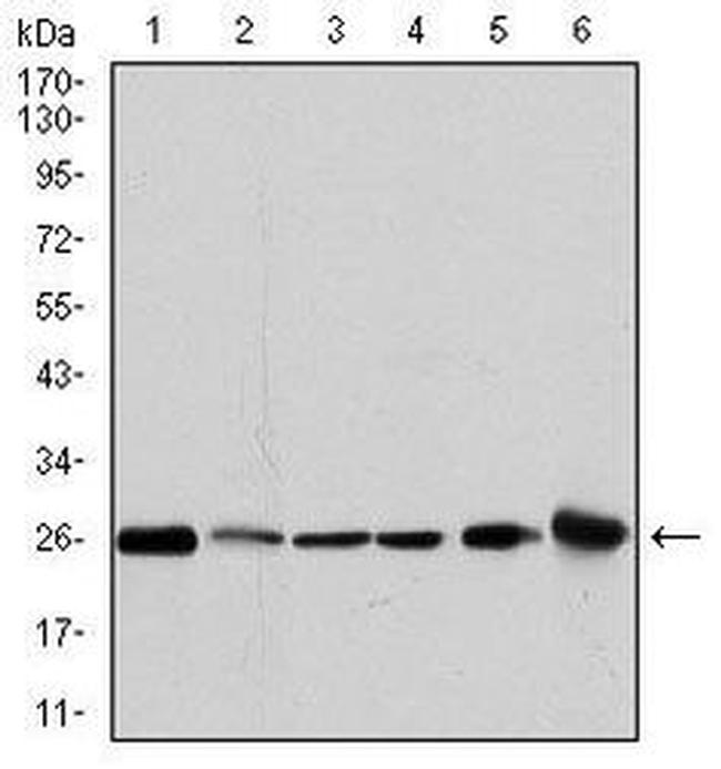 GSTM1 Antibody in Western Blot (WB)