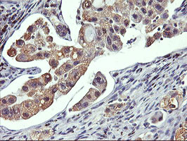 GSTO2 Antibody in Immunohistochemistry (Paraffin) (IHC (P))