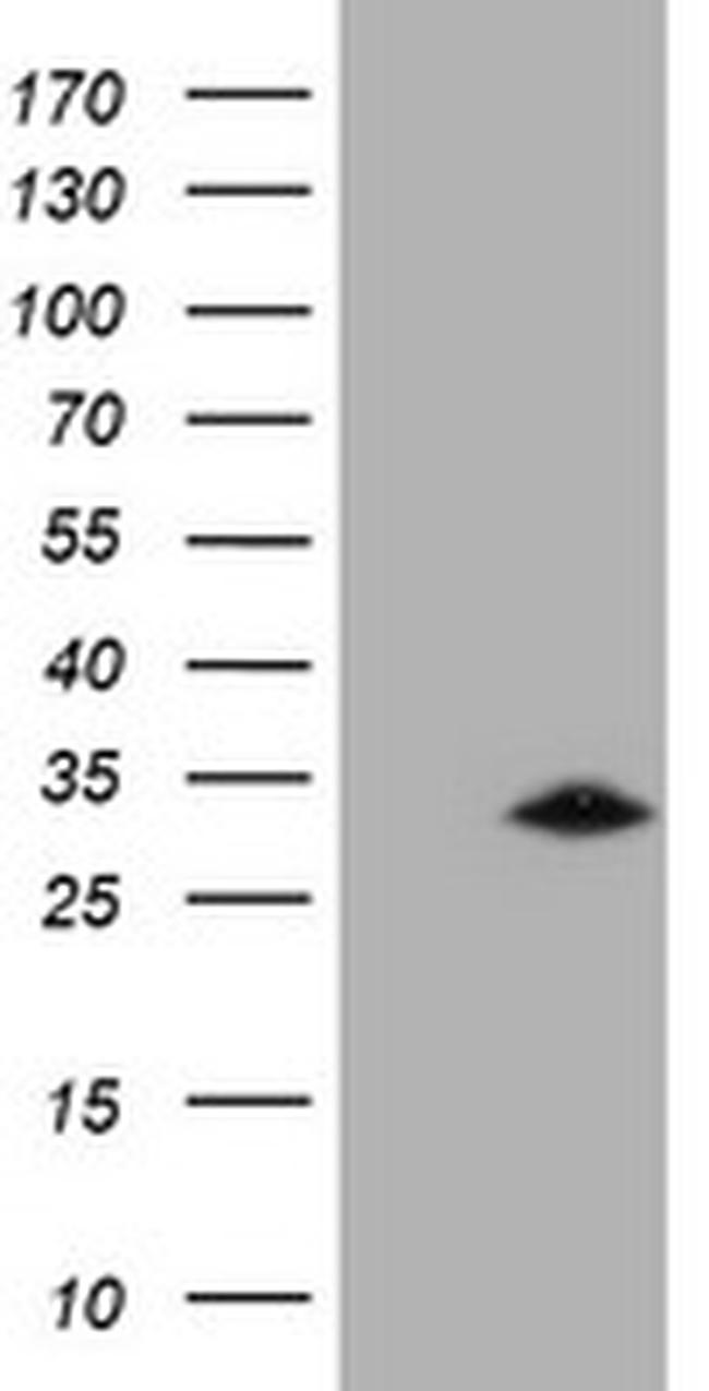 GSTO2 Antibody in Western Blot (WB)