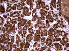 GSTP1 Antibody in Immunohistochemistry (Paraffin) (IHC (P))