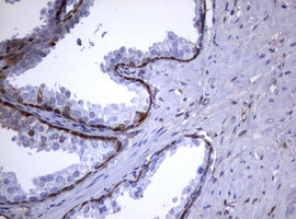 GSTP1 Antibody in Immunohistochemistry (Paraffin) (IHC (P))