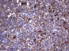 GSTP1 Antibody in Immunohistochemistry (Paraffin) (IHC (P))