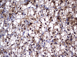 GSTP1 Antibody in Immunohistochemistry (Paraffin) (IHC (P))