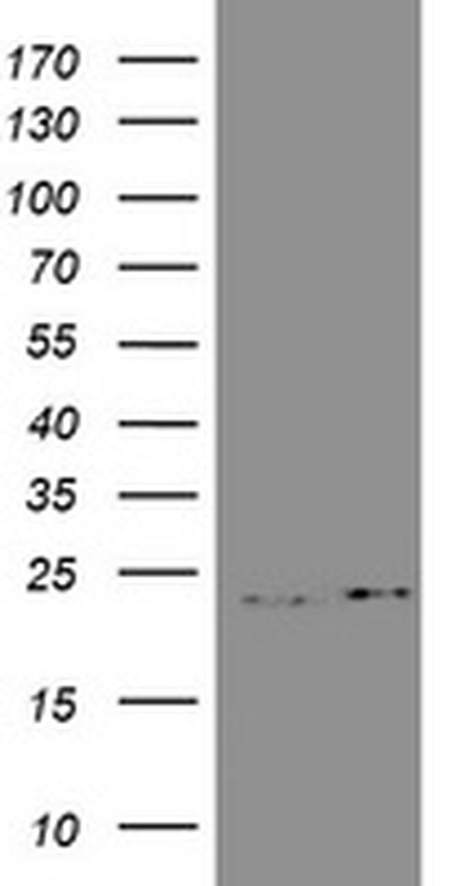 GSTP1 Antibody in Western Blot (WB)