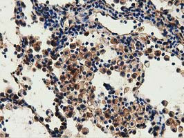 GSTT2 Antibody in Immunohistochemistry (Paraffin) (IHC (P))