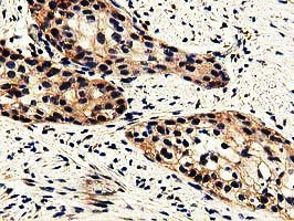 GSTT2 Antibody in Immunohistochemistry (Paraffin) (IHC (P))