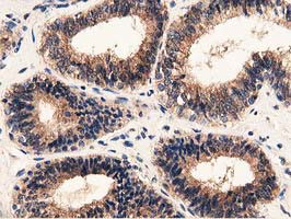 GSTT2 Antibody in Immunohistochemistry (Paraffin) (IHC (P))