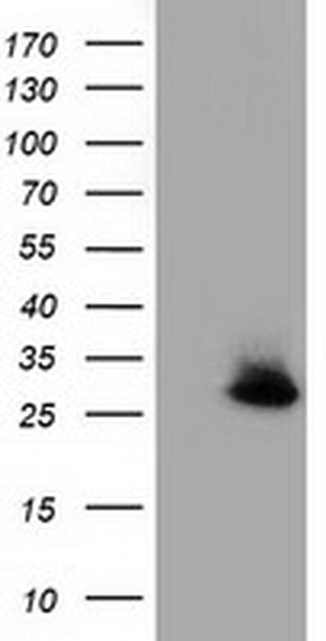 GSTT2 Antibody in Western Blot (WB)