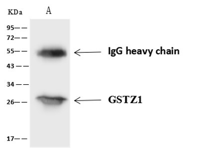 GSTZ1 Antibody in Immunoprecipitation (IP)