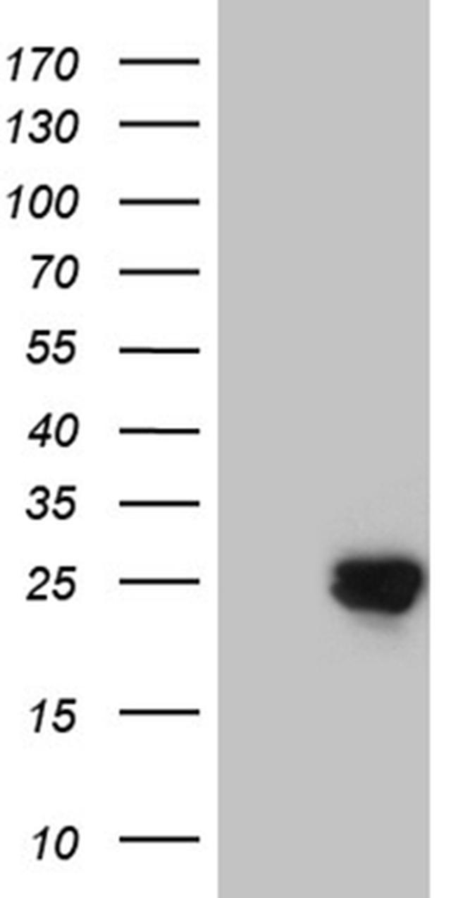 GSTZ1 Antibody in Western Blot (WB)