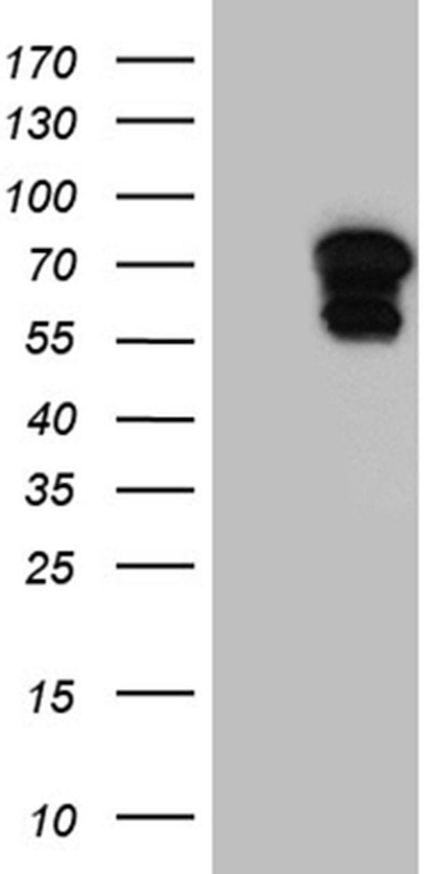 GTF2A1L Antibody in Western Blot (WB)