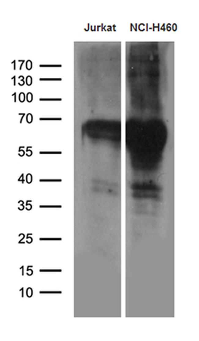 GTF2A1L Antibody in Western Blot (WB)