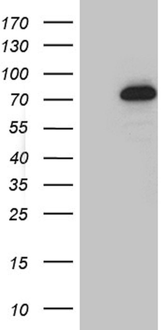 GTF2A1L Antibody in Western Blot (WB)