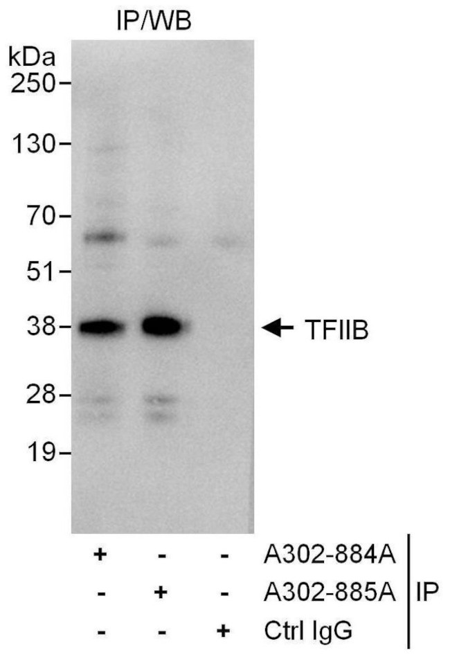 GTF2B/TFIIB Antibody in Immunoprecipitation (IP)