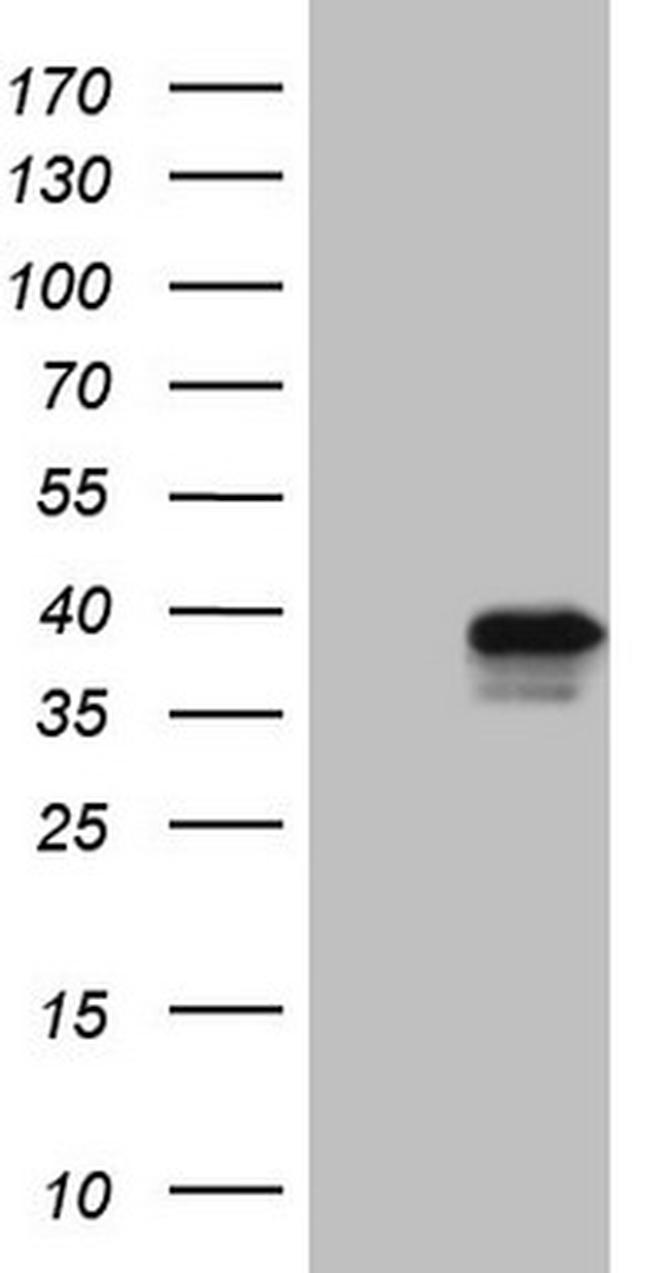 GTF2B Antibody in Western Blot (WB)