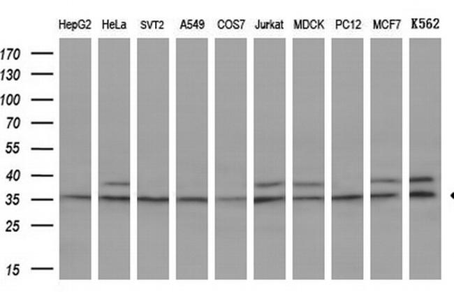 GTF2B Antibody in Western Blot (WB)