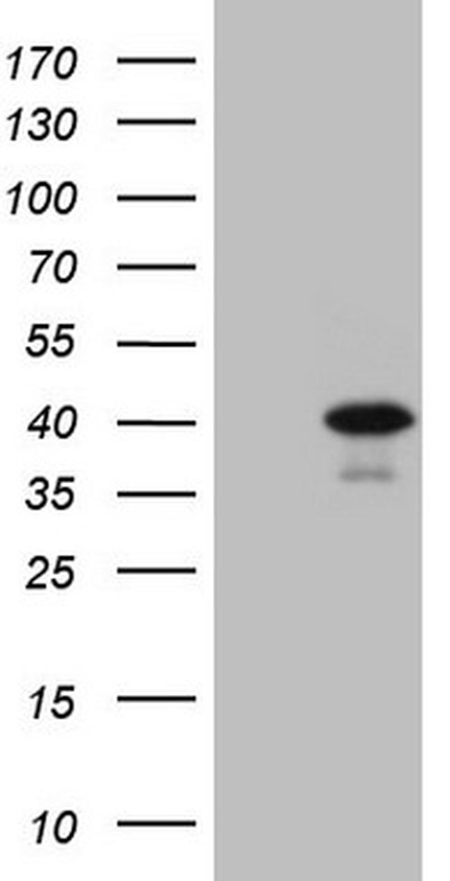 GTF2B Antibody in Western Blot (WB)