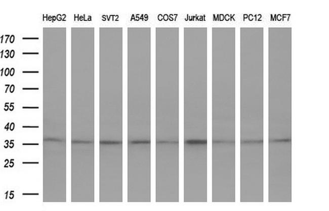 GTF2B Antibody in Western Blot (WB)